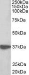 Aminoacyl tRNA synthase complex-interacting multifunctional protein 1 antibody, NBP2-26124, Novus Biologicals, Western Blot image 