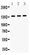 Insulin Receptor Substrate 1 antibody, PB9223, Boster Biological Technology, Western Blot image 