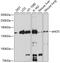 Nitric Oxide Synthase 3 antibody, 16-064, ProSci, Western Blot image 