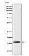 Baculoviral IAP repeat-containing protein 5 antibody, M00379-1, Boster Biological Technology, Western Blot image 