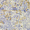 PR/SET Domain 5 antibody, LS-C349088, Lifespan Biosciences, Immunohistochemistry paraffin image 
