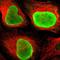 TOP2A antibody, NBP1-86928, Novus Biologicals, Immunocytochemistry image 