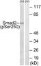 SMAD2 antibody, PA5-38511, Invitrogen Antibodies, Western Blot image 