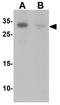 Tctex1 Domain Containing 1 antibody, GTX32084, GeneTex, Western Blot image 