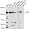 Discoidin Domain Receptor Tyrosine Kinase 2 antibody, GTX64433, GeneTex, Western Blot image 