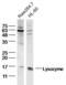 Lysozyme antibody, orb11005, Biorbyt, Western Blot image 