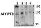 Protein Phosphatase 1 Regulatory Subunit 12A antibody, GTX66636, GeneTex, Western Blot image 