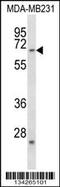 Frizzled Class Receptor 2 antibody, 58-004, ProSci, Western Blot image 