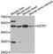 Somatostatin Receptor 1 antibody, LS-C332380, Lifespan Biosciences, Western Blot image 