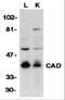 Caspase-activated deoxyribonuclease antibody, 2011, ProSci, Western Blot image 