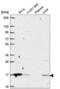 ORMDL Sphingolipid Biosynthesis Regulator 1 antibody, NBP2-56646, Novus Biologicals, Western Blot image 