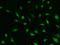 Ubiquitin Conjugating Enzyme E2 N antibody, 201763-T02, Sino Biological, Immunohistochemistry frozen image 
