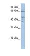 Dihydrolipoamide S-Acetyltransferase antibody, NBP1-54756, Novus Biologicals, Western Blot image 