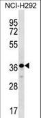 THAP Domain Containing 8 antibody, LS-C157187, Lifespan Biosciences, Western Blot image 