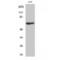 Melatonin-related receptor antibody, LS-C383810, Lifespan Biosciences, Western Blot image 