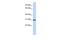 Ring Finger Protein 126 antibody, NBP1-55058, Novus Biologicals, Western Blot image 