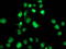 SAM And HD Domain Containing Deoxynucleoside Triphosphate Triphosphohydrolase 1 antibody, LS-B9640, Lifespan Biosciences, Immunofluorescence image 