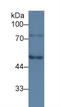 Serpin Family G Member 1 antibody, LS-C292407, Lifespan Biosciences, Western Blot image 