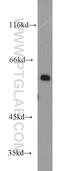 Stress Induced Phosphoprotein 1 antibody, 15218-1-AP, Proteintech Group, Western Blot image 