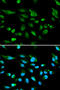 Autoimmune regulator antibody, STJ22559, St John