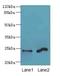 Melanocortin 2 Receptor Accessory Protein 2 antibody, LS-C397819, Lifespan Biosciences, Western Blot image 