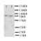 Succinate dehydrogenase [ubiquinone] flavoprotein subunit, mitochondrial antibody, orb76231, Biorbyt, Western Blot image 