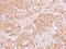 Aldehyde Dehydrogenase 5 Family Member A1 antibody, PA5-29096, Invitrogen Antibodies, Immunohistochemistry paraffin image 