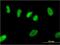 Zinc Finger Protein 101 antibody, MA5-22892, Invitrogen Antibodies, Immunofluorescence image 