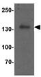Histone Deacetylase 6 antibody, GTX31926, GeneTex, Western Blot image 