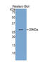 Glucuronidase Beta antibody, LS-C294228, Lifespan Biosciences, Western Blot image 