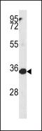 Methylenetetrahydrofolate Dehydrogenase (NADP+ Dependent) 2, Methenyltetrahydrofolate Cyclohydrolase antibody, PA5-14248, Invitrogen Antibodies, Western Blot image 