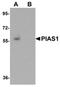 Protein Inhibitor Of Activated STAT 1 antibody, orb75417, Biorbyt, Western Blot image 