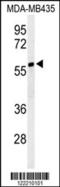 Cytosolic Iron-Sulfur Assembly Component 3 antibody, 64-132, ProSci, Western Blot image 