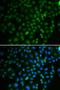 SS-A antibody, LS-C335194, Lifespan Biosciences, Immunofluorescence image 