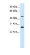 Spermatogenic Leucine Zipper 1 antibody, MBS833148, MyBioSource, Western Blot image 