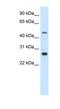 Spermatogenic Leucine Zipper 1 antibody, MBS833148, MyBioSource, Western Blot image 