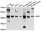 Spermine Synthase antibody, A9154, ABclonal Technology, Western Blot image 