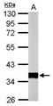 Pyruvate Dehydrogenase E1 Beta Subunit antibody, GTX104040, GeneTex, Western Blot image 