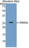 Complement C3d Receptor 2 antibody, LS-C293506, Lifespan Biosciences, Western Blot image 