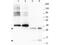 Growth Differentiation Factor 15 antibody, GTX48498, GeneTex, Western Blot image 