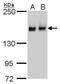 Rho Associated Coiled-Coil Containing Protein Kinase 1 antibody, MA5-27779, Invitrogen Antibodies, Western Blot image 