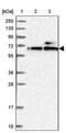 Kelch Domain Containing 4 antibody, PA5-59669, Invitrogen Antibodies, Western Blot image 