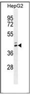 MEF2 Activating Motif And SAP Domain Containing Transcriptional Regulator antibody, AP52592PU-N, Origene, Western Blot image 