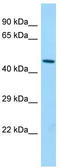 Bleomycin Hydrolase antibody, TA335146, Origene, Western Blot image 
