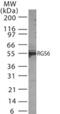 Regulator Of G Protein Signaling 6 antibody, NB100-56659, Novus Biologicals, Western Blot image 