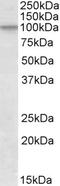 Cullin 2 antibody, EB10058, Everest Biotech, Western Blot image 