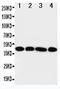 Interleukin 3 Receptor Subunit Alpha antibody, PA1617, Boster Biological Technology, Western Blot image 