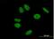Zinc Finger Protein 43 antibody, H00007594-B01P, Novus Biologicals, Immunocytochemistry image 