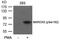 Myristoylated Alanine Rich Protein Kinase C Substrate antibody, PA5-37632, Invitrogen Antibodies, Western Blot image 
