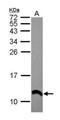 S100 Calcium Binding Protein A2 antibody, GTX121457, GeneTex, Western Blot image 